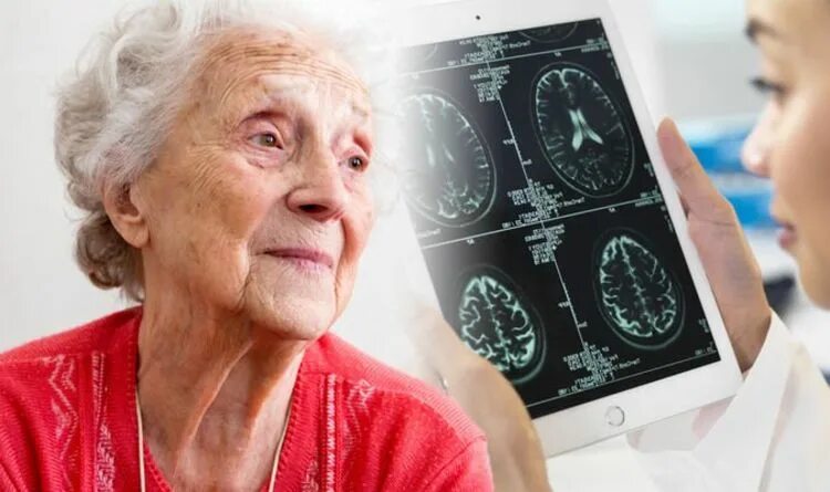Деменция курсы. Тест на деменцию. тест на деменцию картинки. нейропсихологическое тестирование деменция. тест часы для деменции.