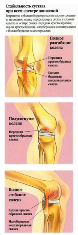 Расслоение связок коленного сустава. Повреждение межменисковой связки коленного сустава. Разрыв крестообразной связки коленного сустава. Повреждение мениска и крестообразной связки.