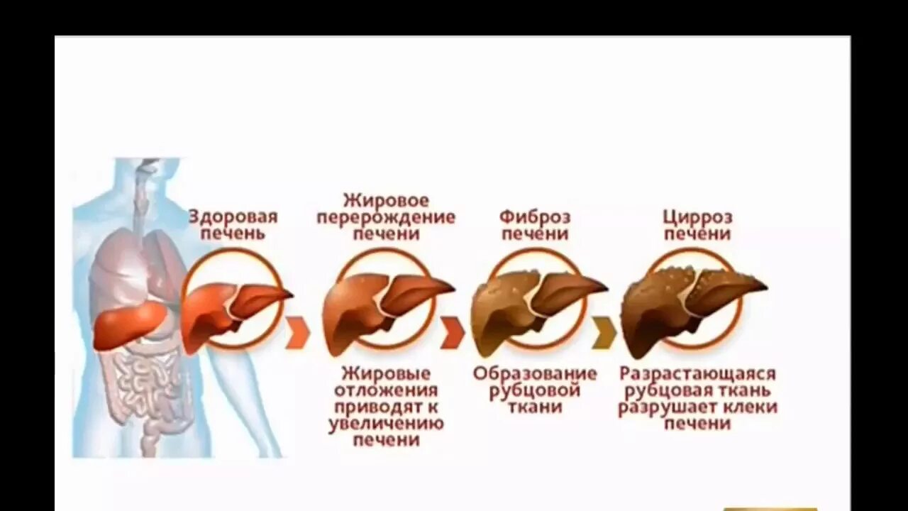 За какое время восстанавливается печень. Печень регенерируется. Печень может регенерировать.