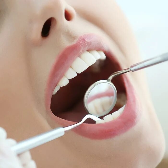 Профессиональная гигиена полости рта. Осмотр стоматолога. Профессиональная чистка зубов. Профилактический осмотр стоматолога.