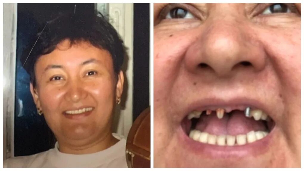 21 05 55. Женщина без верхнего зуба. Работаю в стоматологии у самой страшные зубы. Я не по зубам.