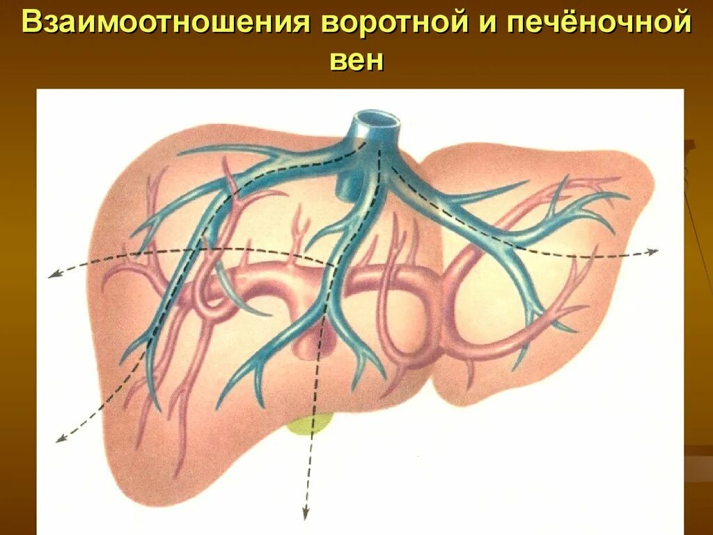 Печень расширены вены. Портальная гипертензия вены. Портальная Вена печени. Портальная гипертензия воротной вены. Внутрипеченочная портальная гипертензия.