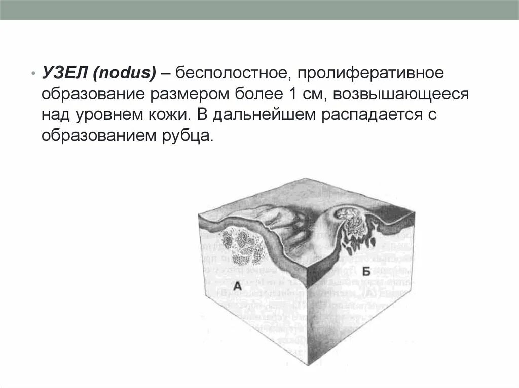 Пятно первичный элемент. Первичные и вторичные элементы кожной сыпи. морфологические элементы сыпи. первичные элементы сыпи узелок. узелок первичный морфологический элемент на коже.