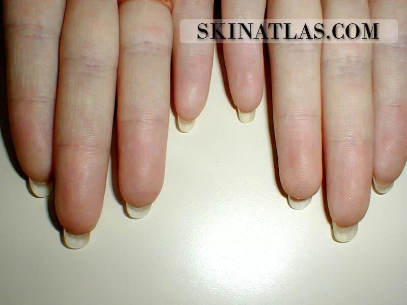 Гипонихий ногтевой пластины. Гипонихий на длинных ногтях. Послойное строение ногтевой пластины. Гипонихий ногтевой пластины. Как называется кожа под ногтем которая отрастает.