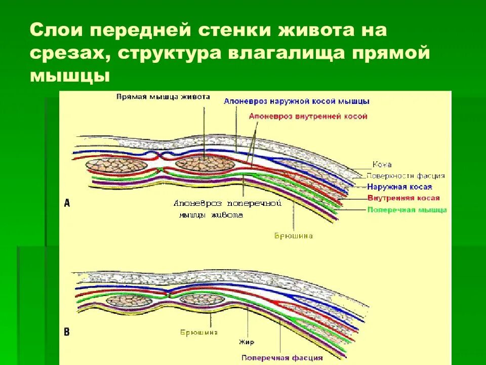 Стенка анатомия. Влагалище прямой мышцы живота схема. Передняя брюшная стенка топографическая анатомия. Переднебоковая брюшная стенка топографическая анатомия. Передняя брюшная стенка топографическая анатомия послойно.
