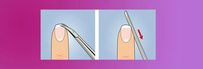 Как подстричь ноготь на пальце. КВУ подстригать ногти на руках. Правильно подстриженные ногти на руках. Правильная стрижка ногтей на руках. Как правильно стричь ногти.