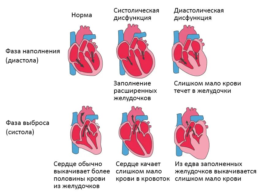 Пассивное наполнение сердца кровью фаза сердечного. Диастолическая функция левого желудочка сердца. Систолическая и диастолическая сердечная недостаточность. Диагностика систолической сердечной недостаточности. Схема систолы и диастолы сердца.