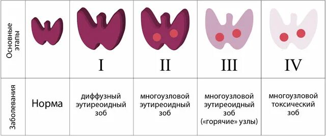 Многоузловой диффузный. Многоузловой диффузный зоб щитовидной железы. Диффузный многоузловой зоб степени. Нетоксический многоузловой зоб степени. Узловой нетоксический зоб щитовидной железы.