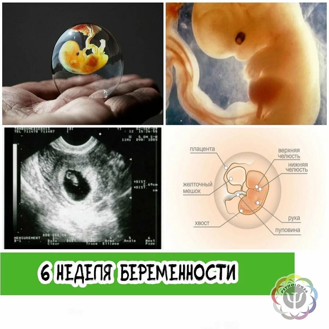 Акушерские недели признаки. Эмбрион на 6 неделе беременности УЗИ. 5 6 Недель беременности фото эмбриона на УЗИ. Как выглядит плод на 5-6 недели на УЗИ. 5-6 Недель беременности фото плода на УЗИ.