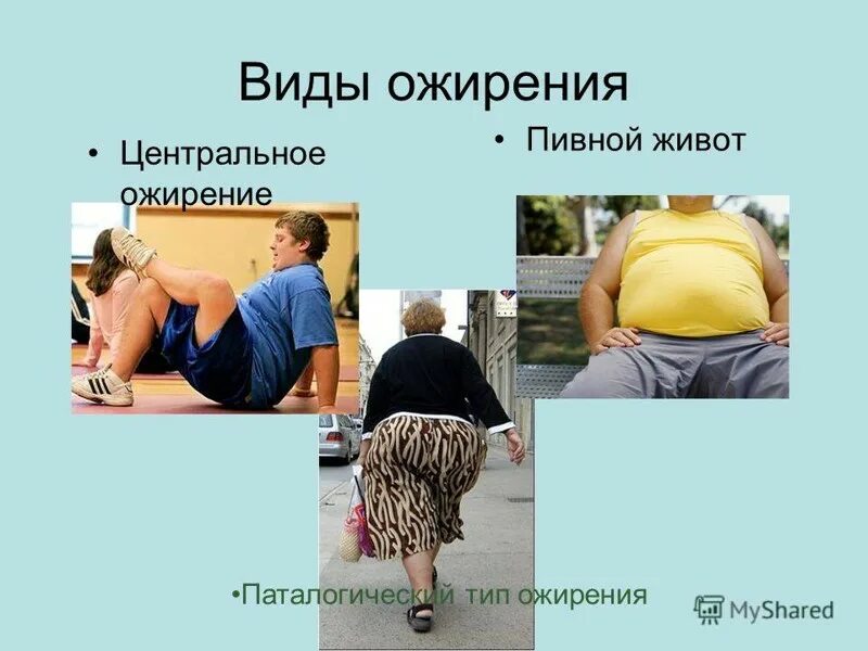 Глютеновое ожирение у женщин