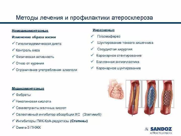 Профилактика атеросклероза. Атеросклероз лечение и профилактика. Атеросклероз и образ жизни. Эффективные лечения атеросклероза