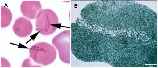 Эритроциты у кошки. Haemobartonella felis. гемобартонеллез микроскопия. гемобартенелез мазок. гемобартенеллез у кошки.