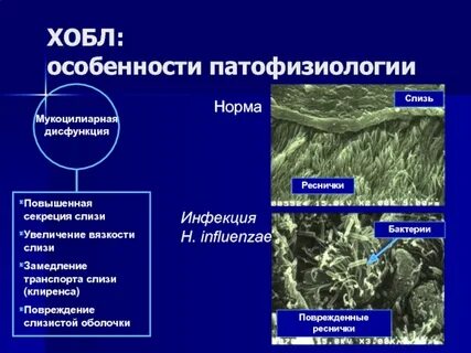 Норма инфекция