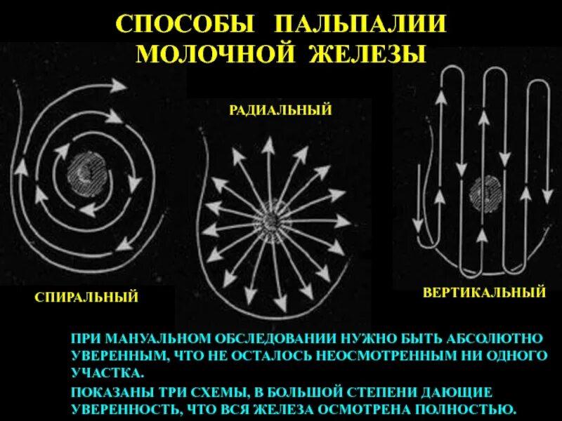 Метод радиальных. Спираль радиальная. радиальный метод. спиральные и радиальные артефакты.
