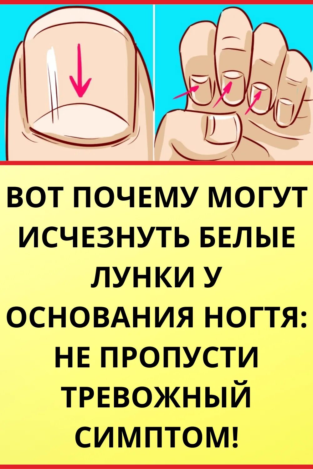 Почему исчезли лунки на ногтях. Определить болезнь по ногтям. болезни по лункам на ногтях. заболевания по ногтям рук.