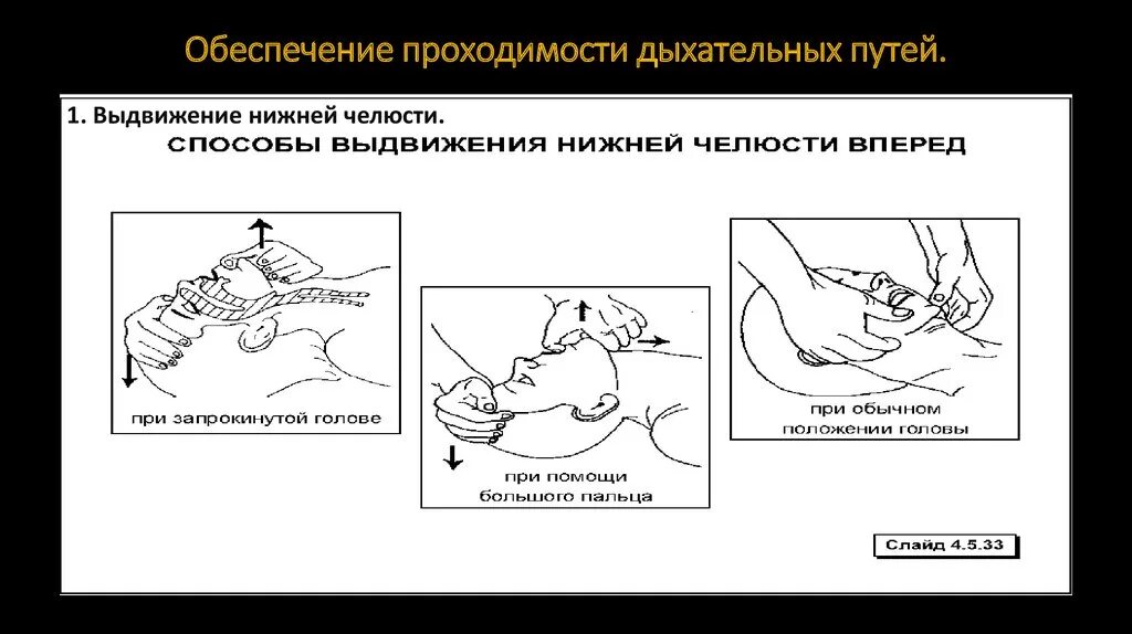 Какие мероприятия по восстановлению проходимости дыхательных путей. Обеспечение проходимости дыхательных путей (воздуховод, мешок Амбу). Оборудование для обеспечения проходимости дыхательных путей. Обеспечить проходимость верхних и нижних дыхательных путей алгоритм. Обеспечение свободной проходимости дыхательных путей.