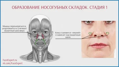 Спазм мышц лица