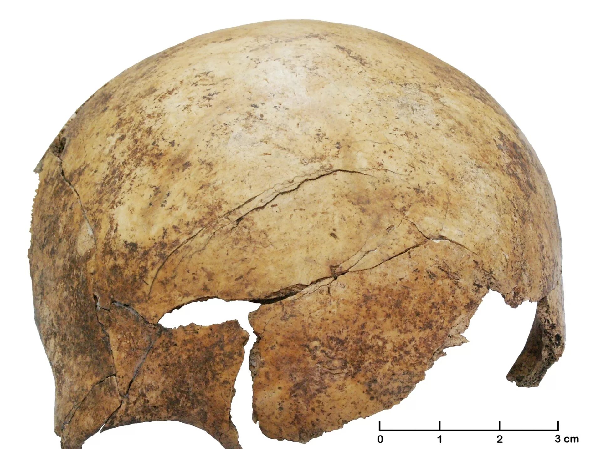 Люди времен неолита форма черепа. Old bone