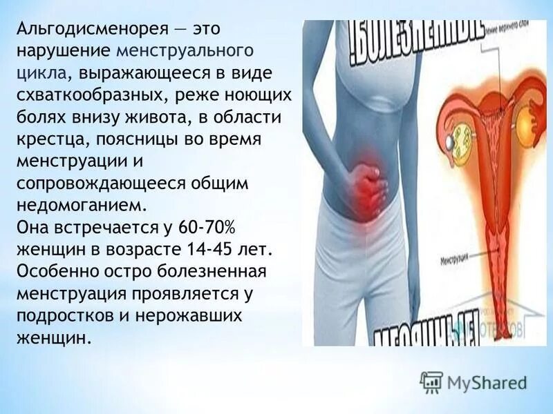 Боли внизу живота при полов акт. Альгодисменорея. Альгодисменорея что это такое у женщин. Болезненные менструации называются. Болезненная менструационного.