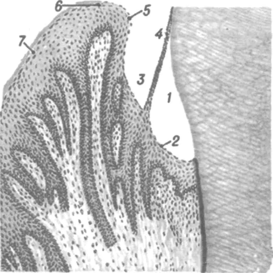 Слои слизистой полости рта. Строение зубодесневой борозды. Десневая борозда гистология. Зубодесневое соединение гистология. Десневой карман гистология.