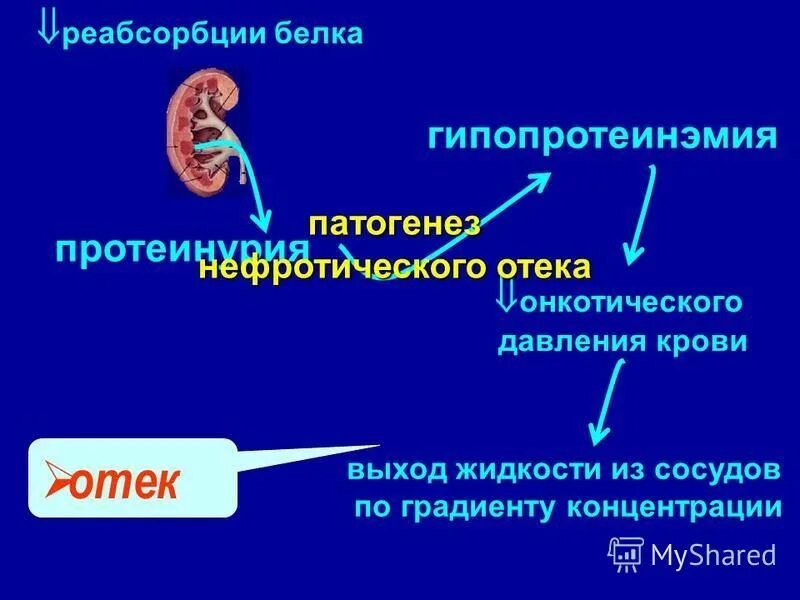 От мозга кровь оттекает. Нефротический синдром патогенез отеков.