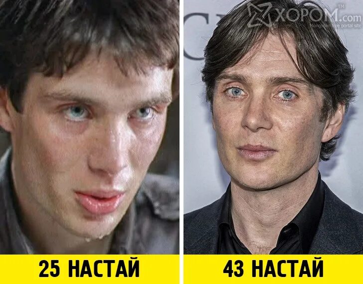 Киллиан мерфи до и после. Киллиан мёрфи до пластики. киллиан мёрфи до и после пластики. киллиан мёрфи в молодости. киллиан мерфи до пластических операций.