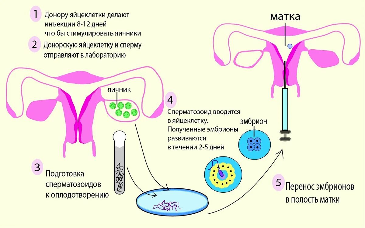 Эко от донора. Эко это искусственное оплодотворение. Донорство яйцеклеток. Яйцеклетка эко. Донорство яйцеклетки (ооцитов).