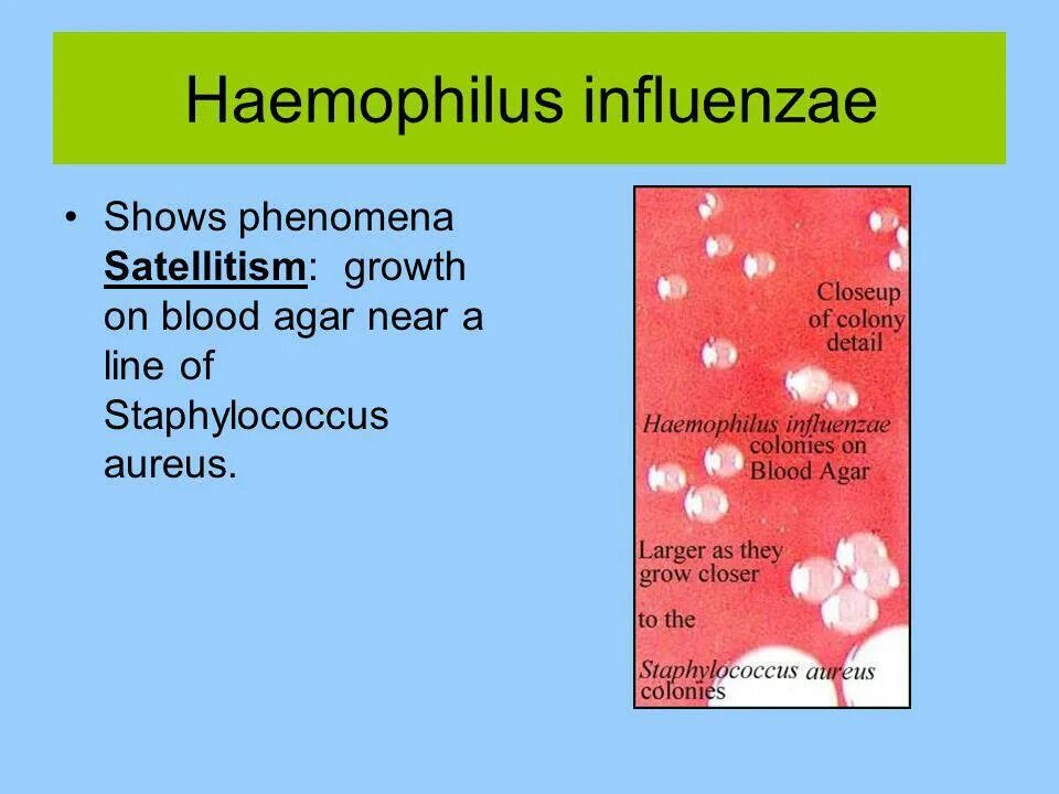 Микрофлора Haemophilus influenzae. Haemophilus influenzae тинкториальные. Гемофильная палочка Афанасьева Пфейффера. Инфекция, вызванная Haemophilus influenzae типа b. Haemophilus influenzae 10