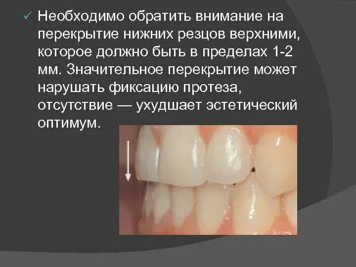 Правильный прикус. Органитический прикус. Глубокий дистальный прикус. Правильный прикус челюсти. Трансверзальные аномалии прикуса перекрестный прикус.