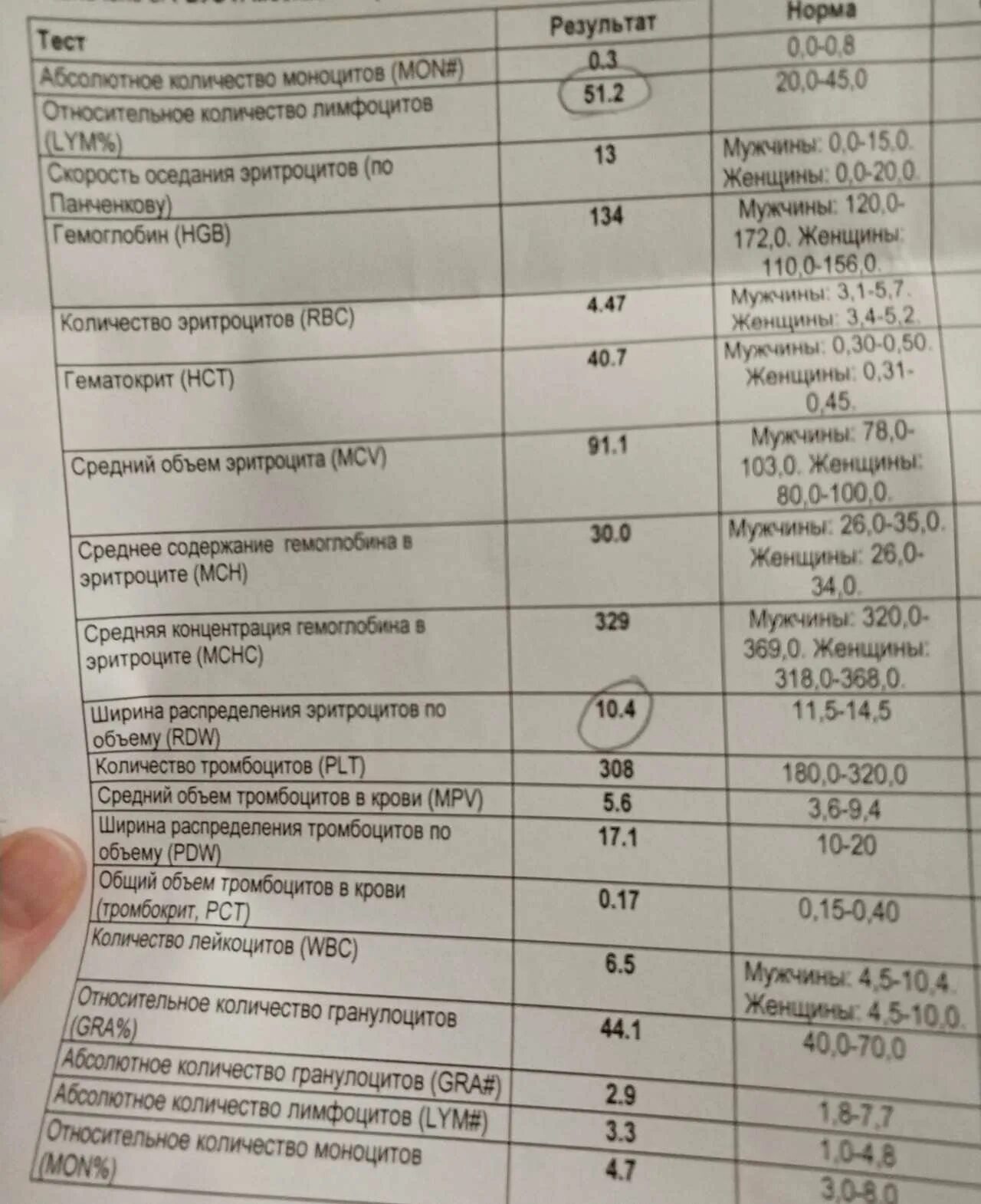 Rdw в крови повышены у мужчины. Лимфоциты показатели нормы. Лимфоциты норма у женщин. Норма лимфоцитов в крови у женщин. Норма лимфоцитов у женщин после 50 лет таблица.