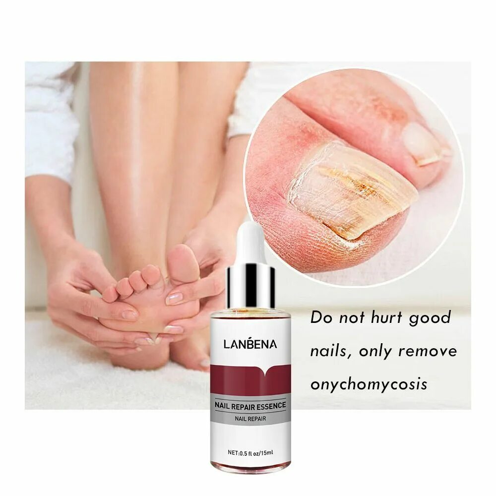 Сыворотка для восстановления ногтей nail fungal solution. Онихолизис ногтей на ногах препараты. Для восстановления ногтей на ногах. Для восстановления ногтей на ногах. Для восстановления ногтей на ногах.
