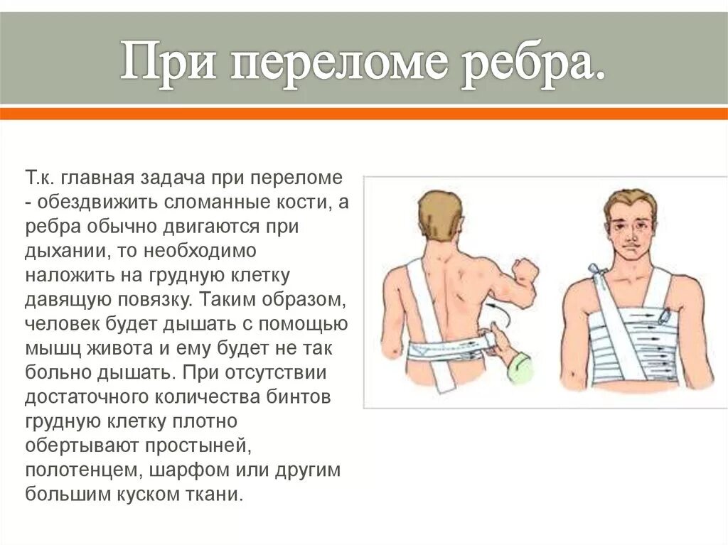 Симптом осевой нагрузки при переломе ребер. Повязка при переломе ребер. Симптомы при переломе ребра. Оказание первой помощи при переломе ребер.