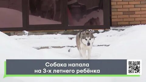 Собака нападает на ребенка видео