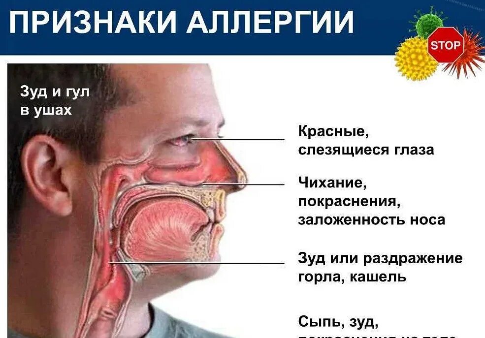 Заложенность носа и першение в горле