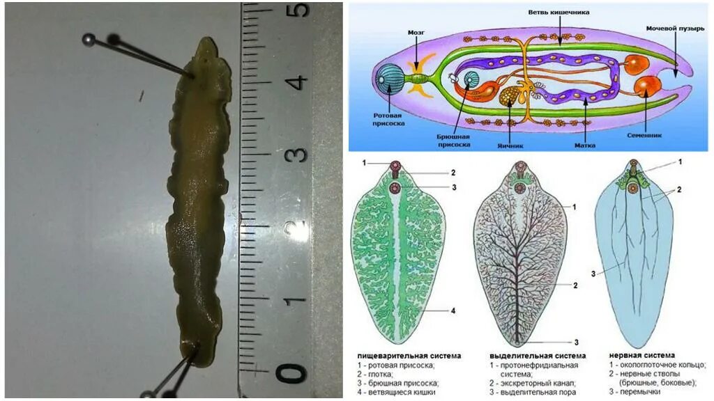 Двуустка печеночный сосальщик. Пищеварительная система печеночного сосальщика. Выделительная система печеночного сосальщика. Строение выделительной системы печеночного сосальщика. Пищеварительная система печеночной двуустки.