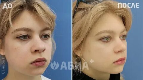 Богданович 53 пластическая хирургия