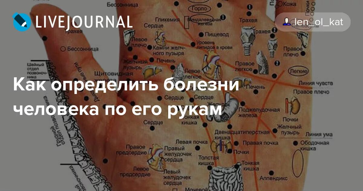 Как определить больной орган. Болезни по руке. Болезни по ладони. Болезни по ладоням рук. Определение болезней по руке.