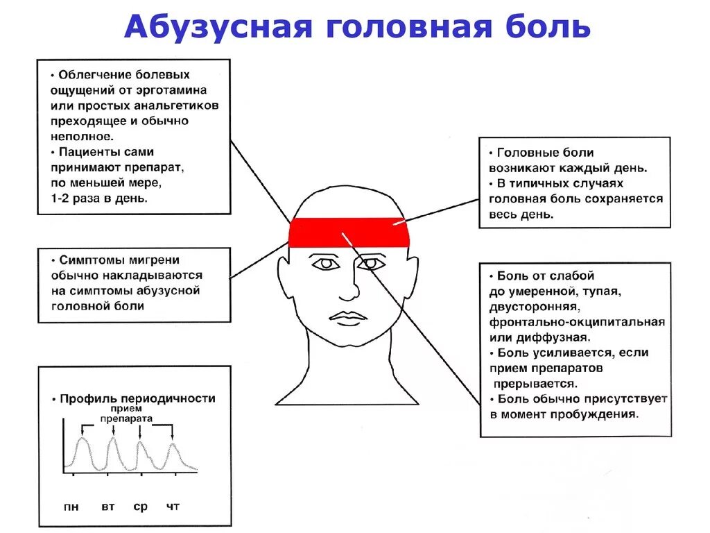 Сдавливает затылок. Схема локализации головной боли. Типы головной боли по зонам. Причины головной боли схема. Типы головной боли по локализации.