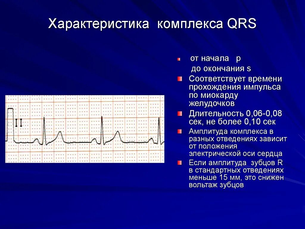 Вольтаж комплекса QRS. ЭКГ схема. Параметры комплекса QRS. Комплекс QRS амплитуда.