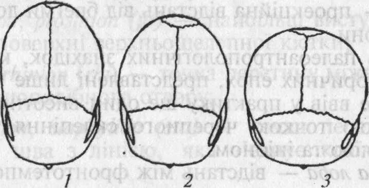 Варианты формы черепа. Долихоцефалическая форма черепа новорожденного. Долихоцефалия форма головы. Мезоцефалическая форма черепа ребенка. Формы черепа человека долихоцефалия брахицефалия мезоцефалия.