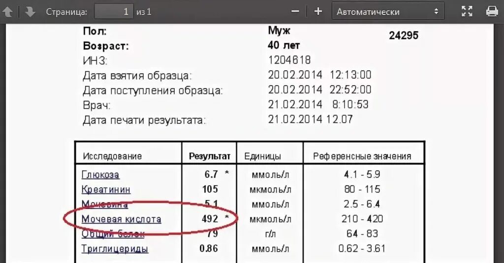 Анализы при подагре у мужчин. Показатели мочевой кислоты в крови норма. Показатели анализа мочевой кислоты в крови. Анализ мочевой кислоты в крови норма. Норма содержания мочевая кислота в плазме крови.