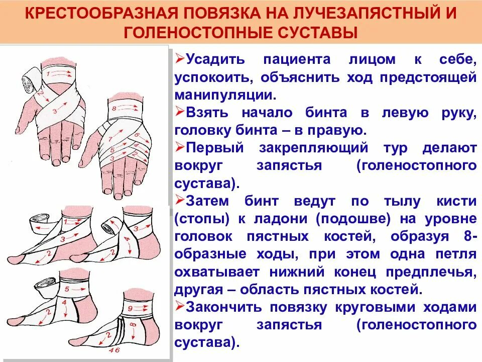 Бинтовая повязка алгоритм. Повязки (правила наложения, виды, схемы). Бинтовые повязки. Наложение бинтовых повязок. Техника наложения бинтовых повязок на руку.