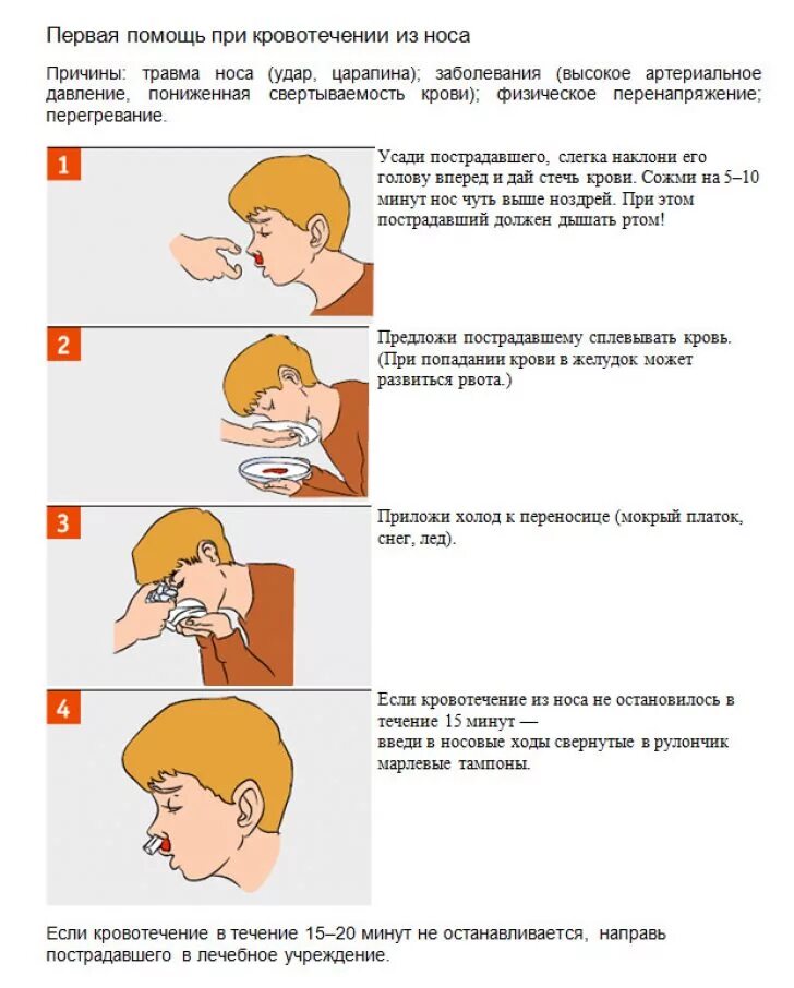 Первая помощь при носовом кровотечении у ребенка. 1 Помощь при носовом кровотечении. Алгоритм действий при кровотечении при носовом кровотечении. Какую первую помощь оказывают при носовом кровотечении. Что надо делать чтобы пошла кровь из носа.