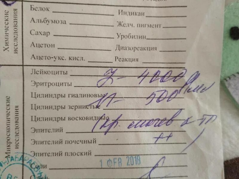 Лейкоциты в моче у ребенка 10 лет. Оам по нечипоренко норма у детей. нечипоренко анализ мочи норма и расшифровка. анализ по нечипоренко норма у взрослых. анализ мочи по нечипоренко норма у детей 10 лет.