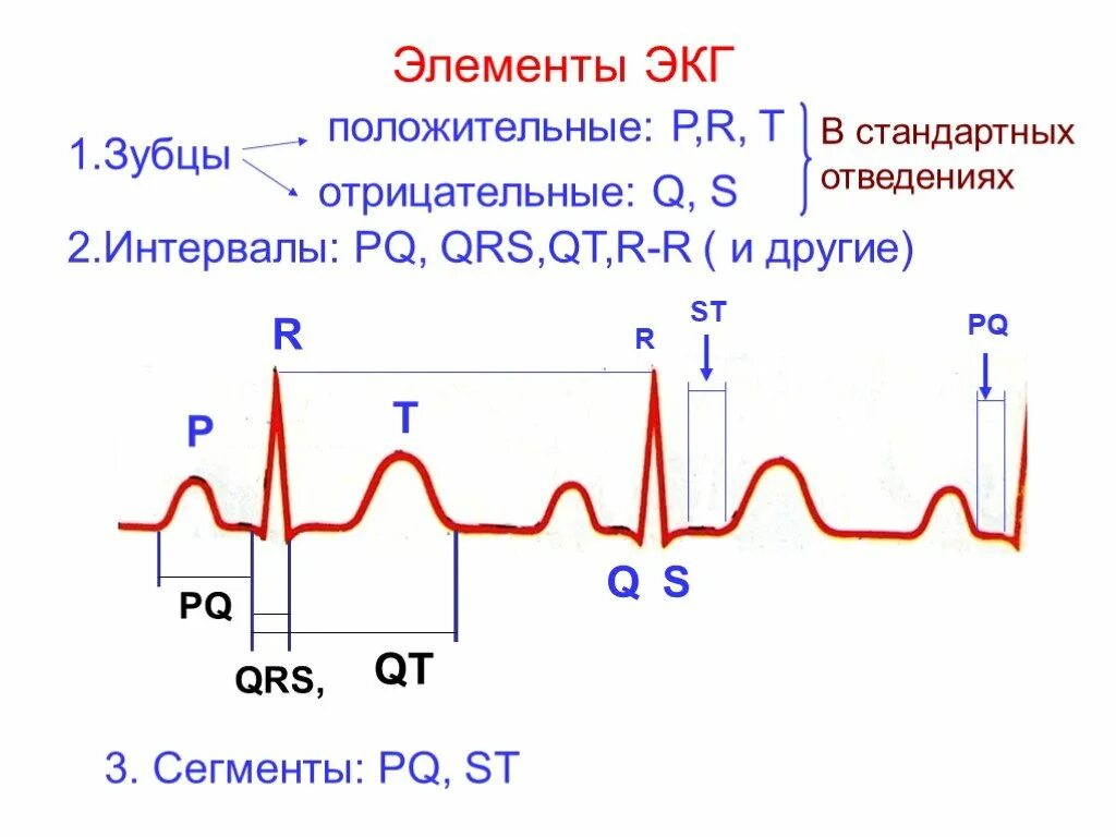 Нарастание зубца. ЭКГ схема зубцов и интервалов. Компоненты нормальной ЭКГ. Элементы нормальной ЭКГ. Нормальное ЭКГ 1 цикл.