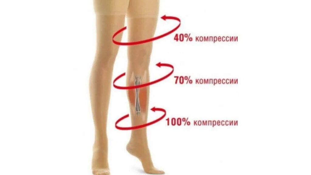 Механизм компрессионного трикотажа. Действие компрессионных чулков при варикозе. Действия компрессионный чулок. Компрессионный трикотаж 2 степени компрессии. Компрессионные колготки класс 2 feel.