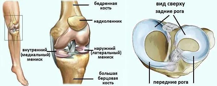 Медиальный мениск коленного сустава анатомия. Медиальное повреждения коленного сустава. Строение мениска задний Рог. Латеральный мениск коленного сустава разрыв. Дегенеративные изменения переднего рога