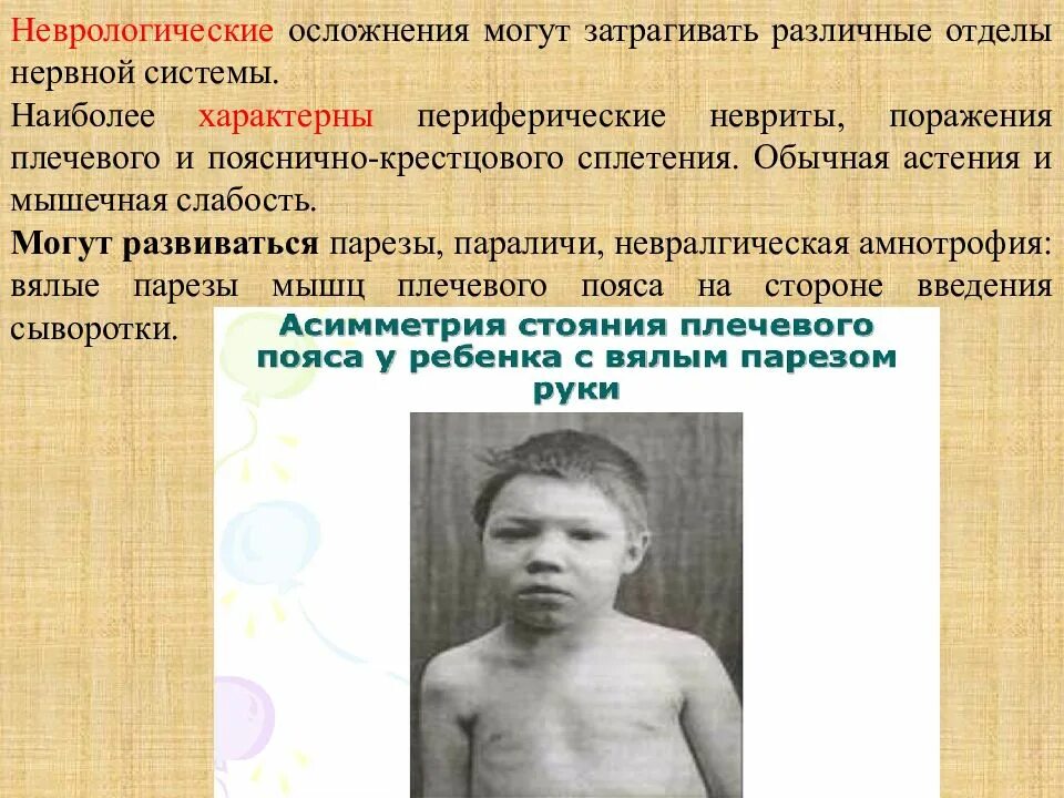 Поражение глазодвигательных мышц. Синдром офтальмоплегия (наружная, внутренняя, тотальная). Центральный и периферический паралич мимических мышц. Периферический паралич. Парез мышц.