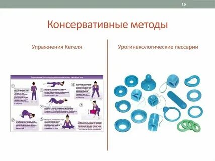 Лечение пролапса тазовых органов у женщин