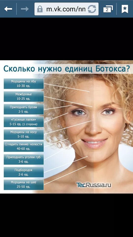Сколько надо ботокса. Сколько надо ботокса